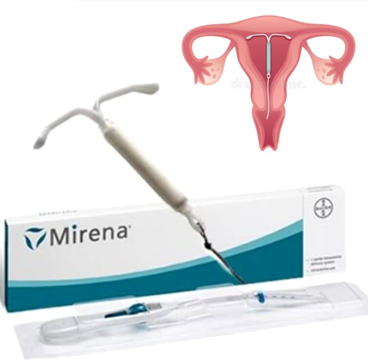 mirena dispositivo intrauterino